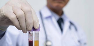 Farmaceutica, Gardini (GenomeUp): “Ai per programmare terapie con plasmaderivati”