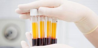 Plasmaderivati, Lecci (Sda Bocconi): “Serve un’innovazione rapida meno costosa”