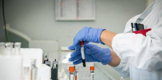 Mielofibrosi, ematologo: “Con uso precoce momelotinib maggiore sopravvivenza”