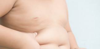 Salute, test genetico predice obesità nei bimbi under 5: maxi-studio internazionale