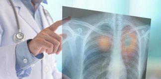 Fine vita, oncologi: “No a Comitato nazionale e a esclusione Ssn, subito confronto”
