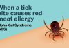 Se una zecca rende allergici a carne e latticini, cos’è la sindrome alfa-gal