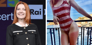 Dalla chioma alle gambe, Noemi ironizza sulla scottatura: “Mai senza crema”