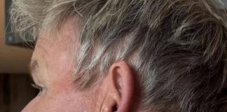 Gordon Ramsay: “Operato per tumore della pelle”