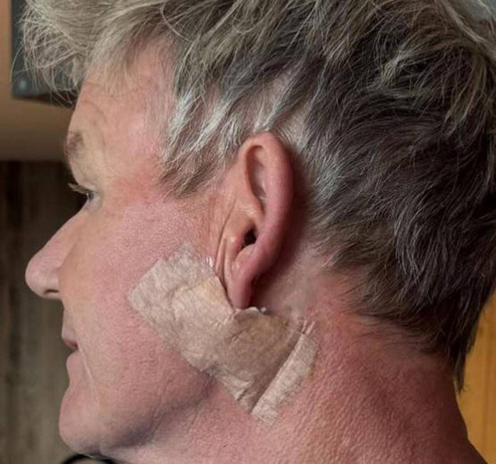 ramsay_operazione_inst