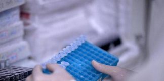 Covid, ecco perché può causare trombosi, studio svela ruolo chiave di un enzima