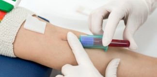 Quistello, Asst comunica la chiusura del punto prelievi per il 4 e 8 settembre