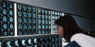 Radiologi Sirm: “Attenzione a medicina difensiva ed esami inappropriati”