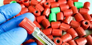 Colesterolo Ldl, per abbassalo in sviluppo nuova terapia con tripla combinazione
