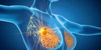 Cancro seno, con profilazione molecolare e terapie target migliori prospettive di cura