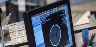 Salute, Padovani (Sin): “Longevità aumenta rischio Alzheimer, agire su prevenzione”