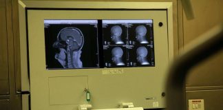 Medicina: Congresso Sin, neurologia tra innovazione, responsabilità e nuova organizzazione