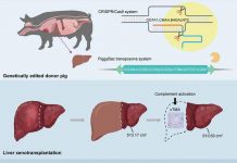 In Cina primo trapianto al mondo di fegato maiale-uomo, ha funzionato per un mese
