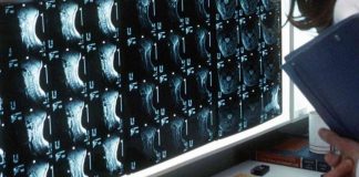 Oltre 500 malattie rare delle ossa, esperti: “Investire in prevenzione e diagnosi”