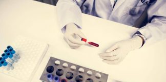 Cancro alla vescica, recidiva ridotta del 32% con immunoterapia durvalumab: lo studio