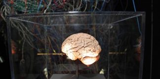 Medicina, neurologi: “L’innovazione può cambiare la storia di molte malattie ma serve equità”