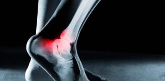 Ossa fragili dei calciatori, ecco perché post ritiro tanti soffrono di osteoartrite