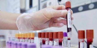 Tumori, cancro vescica: 70% pazienti libero da malattia a 2 anni con terapie perioperatorie