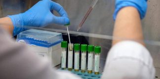 Medicina, italiani svelano errori nascosti nelle cellule: “Possibile ruolo in più malattie”