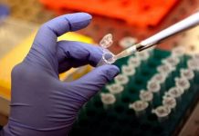 Focolaio di Legionella a Milano: 1 morto e 11 casi in zona San Siro: in corso le indagini di Ats