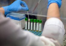 Allerta polio in Germania, virus selvaggio trovato in acque reflue ad Amburgo