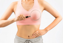 Cancro seno, con test genomici – 48% ricorso a chemioterapia