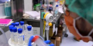 Legionella, il batterio che ama tubature e condizionatori: casi in aumento in Italia