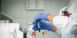 Cordoma del sacro, italiano il primo studio al mondo sull’efficacia dell’adroterapia
