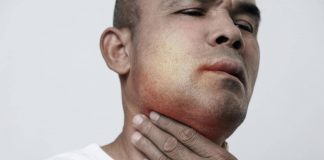 Angioedema ereditario, ok Ue a prima terapia preventiva mirata all’Rna