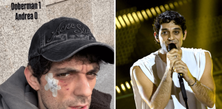 Bresh ferito al volto da un Dobermann, come sta il cantante