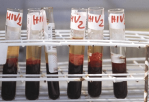 Hiv, oggi a Bari incontro su terapie long acting e prevenzione