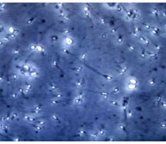 Microplastiche nella prostata e nel liquido seminale, la scoperta italiana: cosa comporta