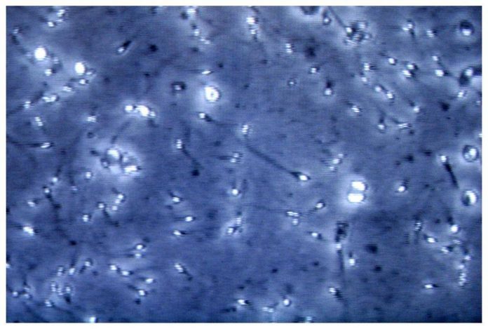 spermatozoi_microscopio_fg