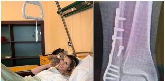 Thais Wiggers, operazione alla caviglia dopo incidente: “Comincio anno con un piede bionico”