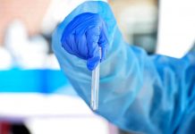 Virus Nipah spaventa l’Asia, Nicastri (Spallanzani): “E’ pericoloso, ma rischio casi d’importazione è virtuale”