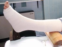 Toccare una frattura nella realtà aumentata, da UniPi sensore tattile low cost