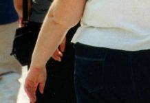 Una morte per malattie infettive su 10 è legata all’obesità, lo studio