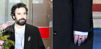 Sanremo, Tommaso Paradiso con la mano fasciata: “Ho fatto un disastro…”