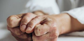 Open day psoriasi, l’11 marzo visite gratis in 90 ospedali Bollino rosa