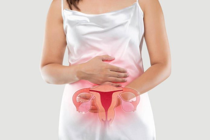 endometriosi_free