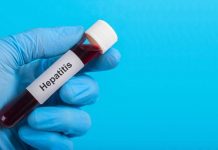 Igienista Triassi: “Focoloaio epatite A punta iceberg”