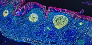 Irccs Pascale Napoli, ‘mappa Gps’ delle cellule rivoluziona l’immunoterapia