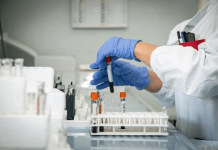 Alzheimer, allo studio nuovo test del sangue per diagnosi precoce