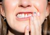 In Italia 9 mln con parodontiti, ‘più cure soft e veloci per fermare boom casi’