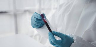 Epatite A in forte crescita in Italia: Lazio, Campania e Puglia le regioni con più casi