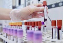 Allarme oncologi: “- 50% trial in Europa in 10 anni mentre Cina accelera”