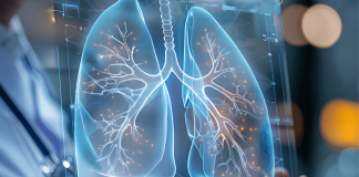 Cancro aggressivo al polmone, con mix di farmaci biologici raddoppia efficacia senza chemio