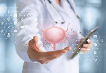 Tumori alla vescica, esperti: “Nel 2025 oltre 29mila diagnosi, 50% casi dovuti a fumo”