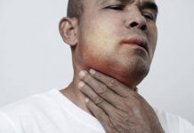 Angioedema ereditario, Aifa estende uso lanadelumab dai 2 anni di età