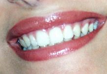 Dentista senza prenotazione a Roma, all’Isola Tiberina visite immediate per urgenze e controlli